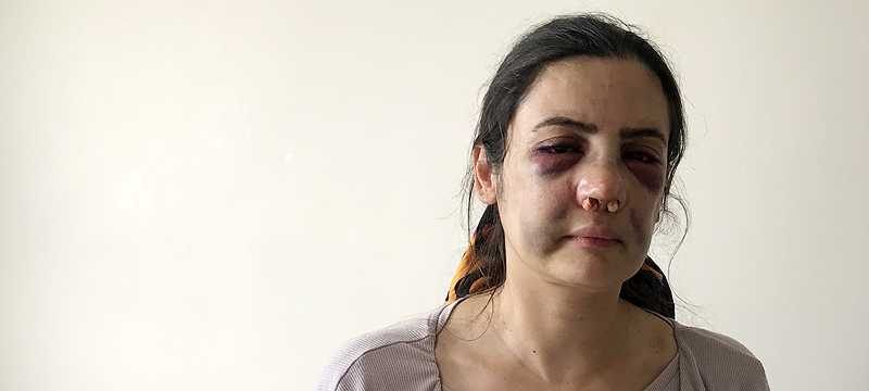 2 çocuk annesi sokak ortasında dehşeti yaşadı
