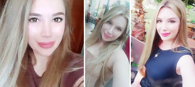 Botoks sonrası ölüm iddiası! Yürüyerek girdi ama...