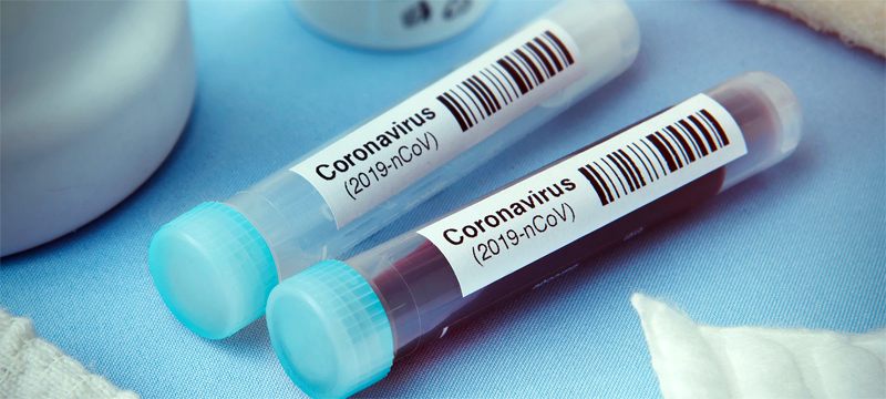 ABD İstihbaratı: Koronavirüs insan yapımı değil