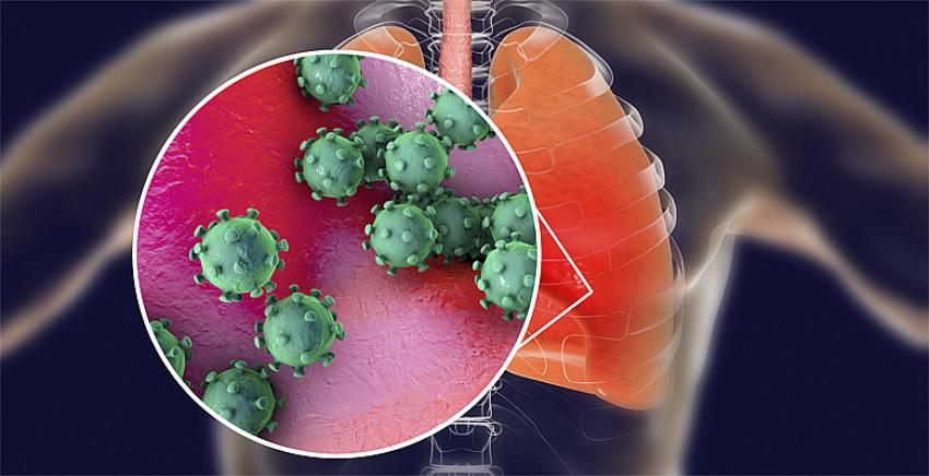 FDA, koronavirüs tedavisi için sıtma ilacına acil onay verdi