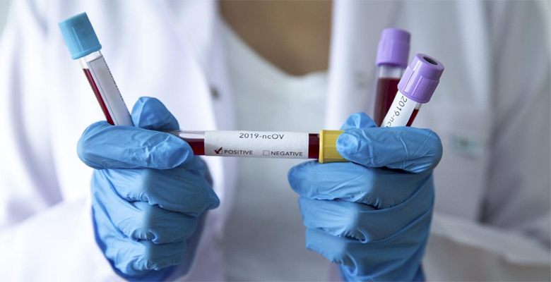 Koronavirüs test sonuçları e-Nabız uygulamasında