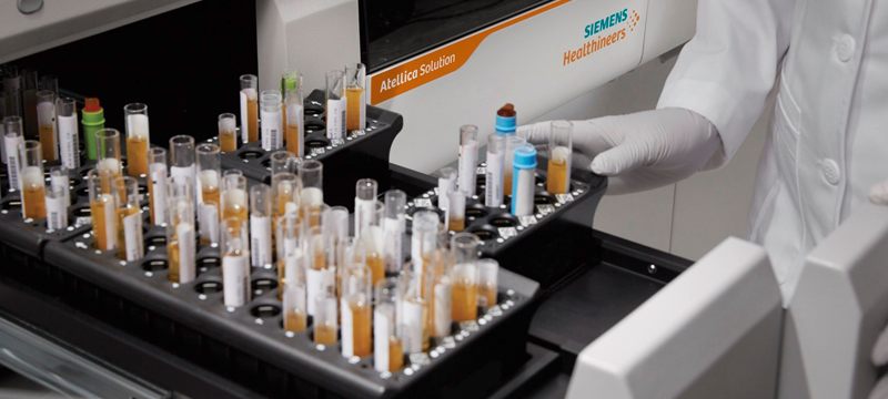 Koronavirüse karşı bağışıklık ölçen test